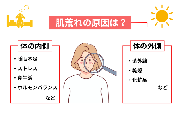 肌荒れの原因とは？